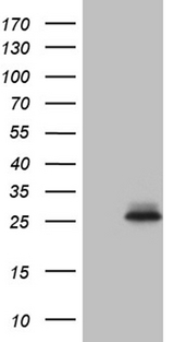 SLC9A1BP / CHP Antibody - HEK293T cells were transfected with the pCMV6-ENTRY control. (Left lane) or pCMV6-ENTRY CHP1. (Right lane) cDNA for 48 hrs and lysed. Equivalent amounts of cell lysates. (5 ug per lane) were separated by SDS-PAGE and immunoblotted with anti-CHP1. (1:2000)