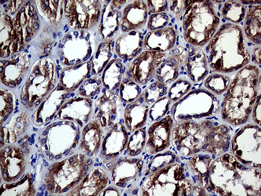 SLC9A1BP / CHP Antibody - Immunohistochemical staining of paraffin-embedded Human Kidney tissue within the normal limits using anti-CHP1 mouse monoclonal antibody. (Heat-induced epitope retrieval by 1mM EDTA in 10mM Tris buffer. (pH8.5) at 120°C for 3 min. (1:250)