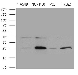 SLC9A1BP / CHP Antibody - Western blot analysis of extracts. (35ug) from 4 different cell lines by using anti-CHP1 monoclonal antibody. (1:500)