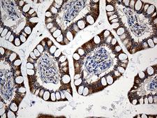 SLC9A1BP / CHP Antibody - Immunohistochemical staining of paraffin-embedded Human colon tissue within the normal limits using anti-CHP mouse monoclonal antibody. (Heat-induced epitope retrieval by 1mM EDTA in 10mM Tris buffer. (pH8.5) at 120°C for 3 min. (1:500)