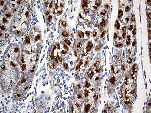 SLC9A1BP / CHP Antibody - Immunohistochemical staining of paraffin-embedded Human gastric tissue within the normal limits using anti-CHP mouse monoclonal antibody. (Heat-induced epitope retrieval by 1mM EDTA in 10mM Tris buffer. (pH8.5) at 120°C for 3 min. (1:500)