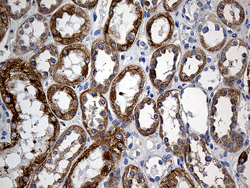 SLC9A1BP / CHP Antibody - Immunohistochemical staining of paraffin-embedded Human Kidney tissue within the normal limits using anti-CHP mouse monoclonal antibody. (Heat-induced epitope retrieval by 1mM EDTA in 10mM Tris buffer. (pH8.5) at 120°C for 3 min. (1:500)