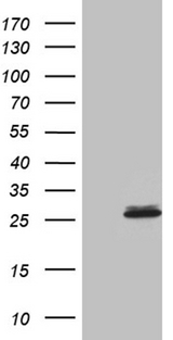 SLC9A1BP / CHP Antibody - HEK293T cells were transfected with the pCMV6-ENTRY control. (Left lane) or pCMV6-ENTRY CHP. (Right lane) cDNA for 48 hrs and lysed. Equivalent amounts of cell lysates. (5 ug per lane) were separated by SDS-PAGE and immunoblotted with anti-CHP. (1:2000)