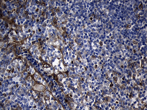 SLC9A1BP / CHP Antibody - Immunohistochemical staining of paraffin-embedded Human tonsil within the normal limits using anti-CHP mouse monoclonal antibody. (Heat-induced epitope retrieval by 1mM EDTA in 10mM Tris buffer. (pH8.5) at 120°C for 3 min. (1:500)