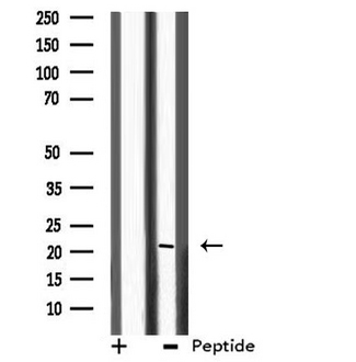 SLC9A1BP / CHP Antibody - Western blot analysis of extracts of HeLa cells using CHP antibody.