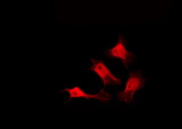 SLC9A1BP / CHP Antibody - Staining HeLa cells by IF/ICC. The samples were fixed with PFA and permeabilized in 0.1% Triton X-100, then blocked in 10% serum for 45 min at 25°C. The primary antibody was diluted at 1:200 and incubated with the sample for 1 hour at 37°C. An Alexa Fluor 594 conjugated goat anti-rabbit IgG (H+L) Ab, diluted at 1/600, was used as the secondary antibody.