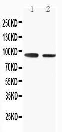SLC9A2 / NHE2 Antibody - WB of SLC9A2 / NHE2 antibody. Lane 1: Rat Skeletal Musle Tissue Lysate. Lane 2: Rat Kidney Tissue Lysate.