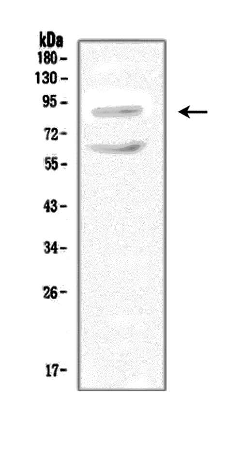 SLC9A2 / NHE2 Antibody - Western blot analysis of SLC9A2 using anti-SLC9A2 antibody. Electrophoresis was performed on a 5-20% SDS-PAGE gel at 70V (Stacking gel) / 90V (Resolving gel) for 2-3 hours. The sample well of each lane was loaded with 50ug of sample under reducing conditions. Lane 1: rat rat kidney tissue lysate. After Electrophoresis, proteins were transferred to a Nitrocellulose membrane at 150mA for 50-90 minutes. Blocked the membrane with 5% Non-fat Milk/ TBS for 1.5 hour at RT. The membrane was incubated with rabbit anti-SLC9A2 antigen affinity purified polyclonal antibody at 0.5 µg/mL overnight at 4°C, then washed with TBS-0.1% Tween 3 times with 5 minutes each and probed with a goat anti-rabbit IgG-HRP secondary antibody at a dilution of 1:10000 for 1.5 hour at RT. The signal is developed using an Enhanced Chemiluminescent detection (ECL) kit with Tanon 5200 system. A specific band was detected for SLC9A2 at approximately 91KD. The expected band size for SLC9A2 is at 91KD.
