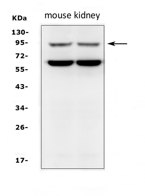 SLC9A2 / NHE2 Antibody - Western blot analysis of SLC9A2 using anti-SLC9A2 antibody. Electrophoresis was performed on a 5-20% SDS-PAGE gel at 70V (Stacking gel) / 90V (Resolving gel) for 2-3 hours. The sample well of each lane was loaded with 50ug of sample under reducing conditions. Lane 1: mouse kidney tissue lysates, Lane 2: mouse kidney tissue lysates. After Electrophoresis, proteins were transferred to a Nitrocellulose membrane at 150mA for 50-90 minutes. Blocked the membrane with 5% Non-fat Milk/ TBS for 1.5 hour at RT. The membrane was incubated with rabbit anti-SLC9A2 antigen affinity purified polyclonal antibody at 0.5 µg/mL overnight at 4°C, then washed with TBS-0.1% Tween 3 times with 5 minutes each and probed with a goat anti-rabbit IgG-HRP secondary antibody at a dilution of 1:10000 for 1.5 hour at RT. The signal is developed using an Enhanced Chemiluminescent detection (ECL) kit with Tanon 5200 system. A specific band was detected for SLC9A2 at approximately 91KD. The expected band size for SLC9A2 is at 91KD.