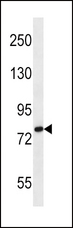 SLC9A2 / NHE2 Antibody - SLC9A2 Antibody western blot of MDA-MB231 cell line lysates (35 ug/lane). The SLC9A2 antibody detected the SLC9A2 protein (arrow).
