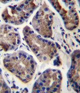 SLC9A2 / NHE2 Antibody - SLC9A2 Antibody immunohistochemistry of formalin-fixed and paraffin-embedded human stomach tissue followed by peroxidase-conjugated secondary antibody and DAB staining.