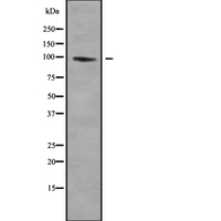 SLC9A3 / NHE3 Antibody - Western blot analysis SLC9A3 using COLO205 whole cells lysates