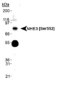 SLC9A3 / NHE3 Antibody - Sodium / Hydrogen Exchanger 3 [phospho Ser552] Antibody (14D5) - Detection of NHE3 [S552] in human kidney lysate..  This image was taken for the unconjugated form of this product. Other forms have not been tested.