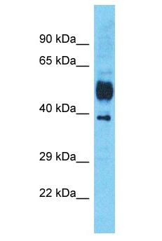 SLC9A3R1 / NHERF1 / EBP50 Antibody - SLC9A3R1 / NHERF1 / EBP50 antibody Western Blot of Esophagus Tumor. Antibody dilution: 1 ug/ml.  This image was taken for the unconjugated form of this product. Other forms have not been tested.