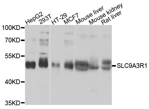 SLC9A3R1 / NHERF1 / EBP50 Antibody - Western blot analysis of extracts of various cell lines, using SLC9A3R1 antibody at 1:1000 dilution. The secondary antibody used was an HRP Goat Anti-Rabbit IgG (H+L) at 1:10000 dilution. Lysates were loaded 25ug per lane and 3% nonfat dry milk in TBST was used for blocking. An ECL Kit was used for detection and the exposure time was 1s.