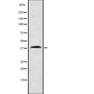 SLC9A3R1 / NHERF1 / EBP50 Antibody - Western blot analysis SLC9A3R1 using COLO205 whole cells lysates