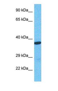 SLC9A3R1 / NHERF1 / EBP50 Antibody - Western blot of NHRF1 Antibody with human 786-0 Whole Cell lysate.  This image was taken for the unconjugated form of this product. Other forms have not been tested.
