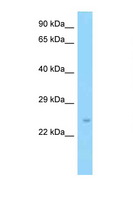SLC9A3R2 / SIP1 Antibody - SLC9A3R2 antibody Western blot of Mouse Liver lysate. Antibody concentration 1 ug/ml.  This image was taken for the unconjugated form of this product. Other forms have not been tested.
