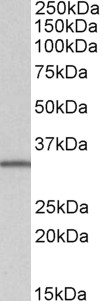 SLC9A3R2 / SIP1 Antibody - Goat Anti-NHERF2 (isoform b) Antibody (1µg/ml) staining of Daudi lysate (35µg protein in RIPA buffer). Primary incubation was 1 hour. Detected by chemiluminescencence.