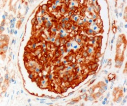 SLC9A3R2 / SIP1 Antibody - Goat Anti-NHERF2 (isoform a) Antibody (3µg/ml) staining of paraffin embedded Human Kidney. Microwaved antigen retrieval with Tris/EDTA buffer pH9, HRP-staining.