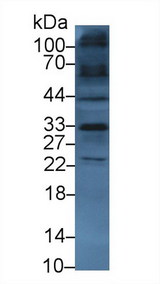 SLC9A3R2 / SIP1 Antibody - Western Blot; Sample: Mouse Heart lysate; Primary Ab: 3µg/ml Rabbit Anti-Human TKA1 Antibody Second Ab: 0.2µg/mL HRP-Linked Caprine Anti-Rabbit IgG Polyclonal Antibody