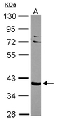 SLC9A3R2 / SIP1 Antibody - Sample (30 ug of whole cell lysate). A: NT2D1. 10% SDS PAGE. SLC9A3R2 / SIP-1 antibody diluted at 1:1000.