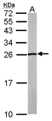 SLC9A3R2 / SIP1 Antibody - Sample (50 ug of whole cell lysate). A: mouse liver. 15% SDS PAGE. SLC9A3R2 / SIP-1 antibody diluted at 1:1000.