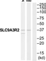 SLC9A3R2 / SIP1 Antibody - Western blot of extracts from JK cells and K562 cells, using SLC9A3R2 antibody.