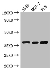 SLC9A3R2 / SIP1 Antibody - Positive WB detected in:A549 whole cell lysate,MCF-7 whole cell lysate,PC3 whole cell lysate;All lanes:SLC9A3R2 antibody at 3ug/ml;Secondary;Goat polyclonal to rabbit IgG at 1/50000 dilution;Predicted band size: 38,37,25 kDa;Observed band size: 38 kDa;