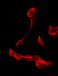 SLC9A3R2 / SIP1 Antibody - Staining JK cells by IF/ICC. The samples were fixed with PFA and permeabilized in 0.1% Triton X-100, then blocked in 10% serum for 45 min at 25°C. The primary antibody was diluted at 1:200 and incubated with the sample for 1 hour at 37°C. An Alexa Fluor 594 conjugated goat anti-rabbit IgG (H+L) Ab, diluted at 1/600, was used as the secondary antibody.