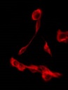 SLC9A3R2 / SIP1 Antibody - Staining JK cells by IF/ICC. The samples were fixed with PFA and permeabilized in 0.1% Triton X-100, then blocked in 10% serum for 45 min at 25°C. The primary antibody was diluted at 1:200 and incubated with the sample for 1 hour at 37°C. An Alexa Fluor 594 conjugated goat anti-rabbit IgG (H+L) Ab, diluted at 1/600, was used as the secondary antibody.