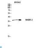 SLC9A3R2 / SIP1 Antibody - Western Blot (WB) analysis of JK K562 using NHERF-2 antibody.