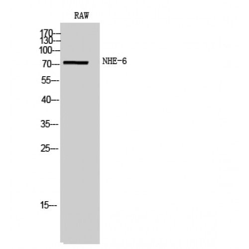 SLC9A6 Antibody - Western blot of NHE-6 antibody