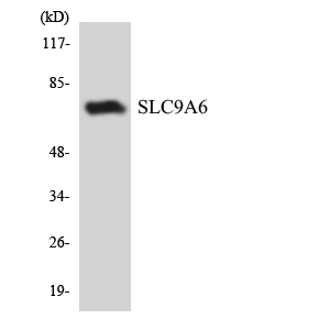 SLC9A6 Antibody - Western blot analysis of the lysates from COLO205 cells using SLC9A6 antibody.