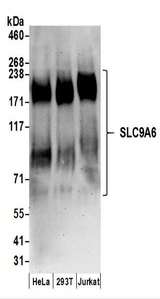 SLC9A6 Antibody - Detection of Human SLC9A6 by Western Blot. Samples: Whole cell lysate (50 ug) prepared using NETN buffer from HeLa, 293T, and Jurkat cells. Antibodies: Affinity purified rabbit anti-SLC9A6 antibody used for WB at 0.1 ug/ml. Detection: Chemiluminescence with an exposure time of 3 minutes.