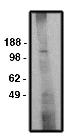 SLC9A6 Antibody - Western blot of NHE6 antibody on human brain lysate (15 ug/lane). Antibody used at 10 ug/ml. Secondary antibody, mouse anti-rabbit, used at 1:150K dilution.