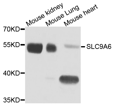 SLC9A6 Antibody - Western blot analysis of extract of various cells.