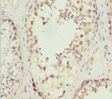 SLC9A6 Antibody - Immunohistochemistry of paraffin-embedded human testis tissue at dilution 1:100