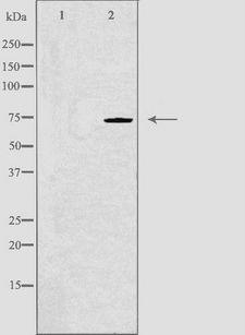 SLC9A6 Antibody - Western blot analysis of extracts of RAW264.7 cells using SLC9A6 antibody. The lane on the left is treated with the antigen-specific peptide.