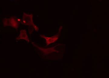 SLC9A6 Antibody - Staining RAW264.7 cells by IF/ICC. The samples were fixed with PFA and permeabilized in 0.1% Triton X-100, then blocked in 10% serum for 45 min at 25°C. The primary antibody was diluted at 1:200 and incubated with the sample for 1 hour at 37°C. An Alexa Fluor 594 conjugated goat anti-rabbit IgG (H+L) antibody, diluted at 1/600, was used as secondary antibody.