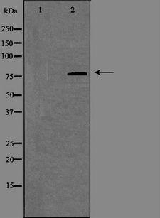 SLC9A7 Antibody - Western blot analysis of extracts of COLO cells using SLC9A7 antibody.