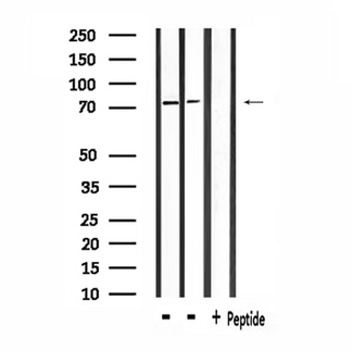 SLC9A7 Antibody - Western blot analysis of extracts of HeLa and mouse lung using SLC9A7 antibody.