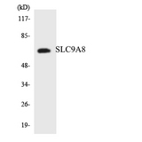 SLC9A8 / NHE8 Antibody - Western blot analysis of the lysates from HeLa cells using SLC9A8 antibody.