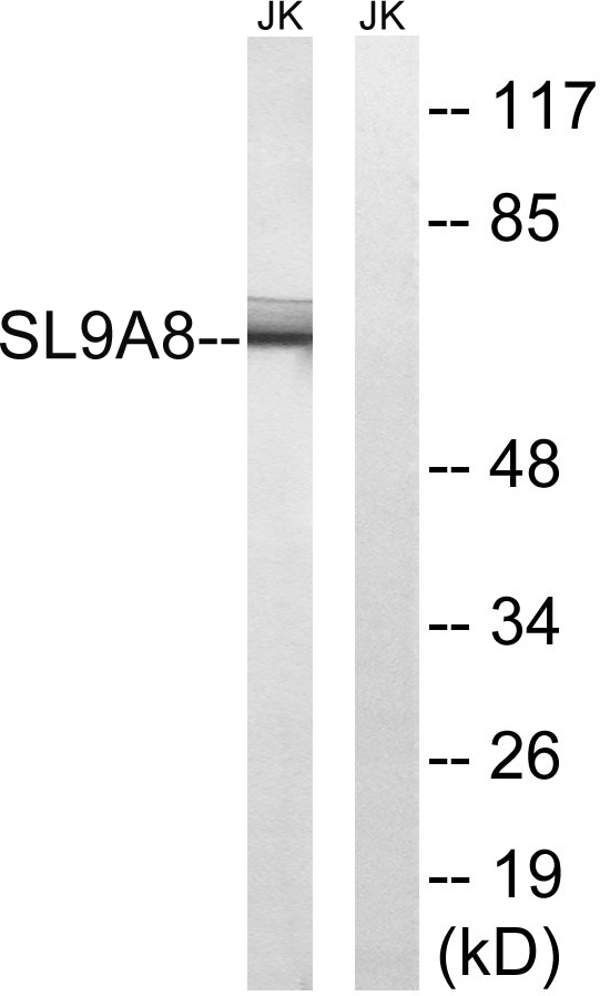 SLC9A8 / NHE8 Antibody - Western blot analysis of lysates from Jurkat cells, using SLC9A8 Antibody. The lane on the right is blocked with the synthesized peptide.