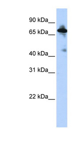 SLC9A8 / NHE8 Antibody - SLC9A8 antibody Western blot of HepG2 cell lysate. This image was taken for the unconjugated form of this product. Other forms have not been tested.