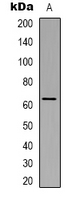 SLC9A8 / NHE8 Antibody - Western blot analysis of NHE8 expression in HepG2 (A) whole cell lysates.