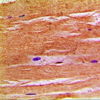 SLC9A8 / NHE8 Antibody - Immunohistochemical analysis of NHE8 staining in human skeletal muscle formalin fixed paraffin embedded tissue section. The section was pre-treated using heat mediated antigen retrieval with sodium citrate buffer (pH 6.0). The section was then incubated with the antibody at room temperature and detected with HRP and DAB as chromogen. The section was then counterstained with hematoxylin and mounted with DPX.