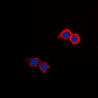 SLC9A8 / NHE8 Antibody - Immunofluorescent analysis of NHE8 staining in HepG2 cells. Formalin-fixed cells were permeabilized with 0.1% Triton X-100 in TBS for 5-10 minutes and blocked with 3% BSA-PBS for 30 minutes at room temperature. Cells were probed with the primary antibody in 3% BSA-PBS and incubated overnight at 4 deg C in a humidified chamber. Cells were washed with PBST and incubated with a DyLight 594-conjugated secondary antibody (red) in PBS at room temperature in the dark. DAPI was used to stain the cell nuclei (blue).