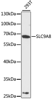SLC9A8 / NHE8 Antibody - Western blot analysis of extracts of 293T cells, using SLC9A8 antibody at 1:3000 dilution. The secondary antibody used was an HRP Goat Anti-Rabbit IgG (H+L) at 1:10000 dilution. Lysates were loaded 25ug per lane and 3% nonfat dry milk in TBST was used for blocking. An ECL Kit was used for detection and the exposure time was 90s.