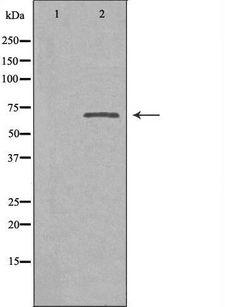 SLC9A8 / NHE8 Antibody - Western blot analysis of extracts of Jurkat cells using SLC9A8 antibody. The lane on the left is treated with the antigen-specific peptide.